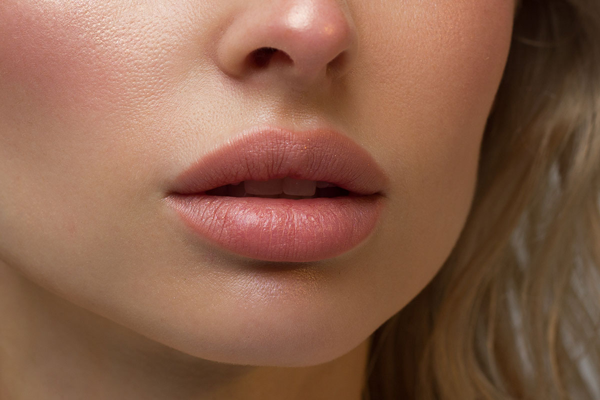Lip Augmentation