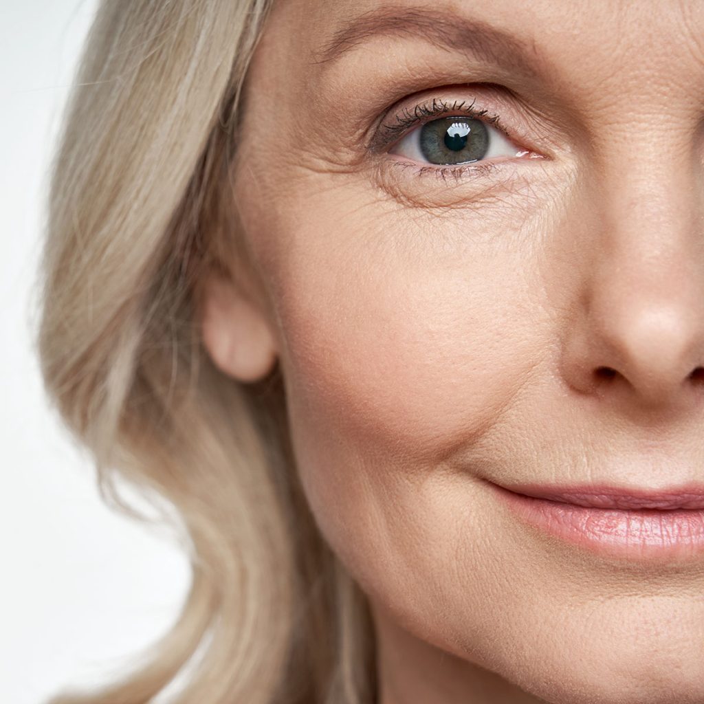 Eyelid Surgery