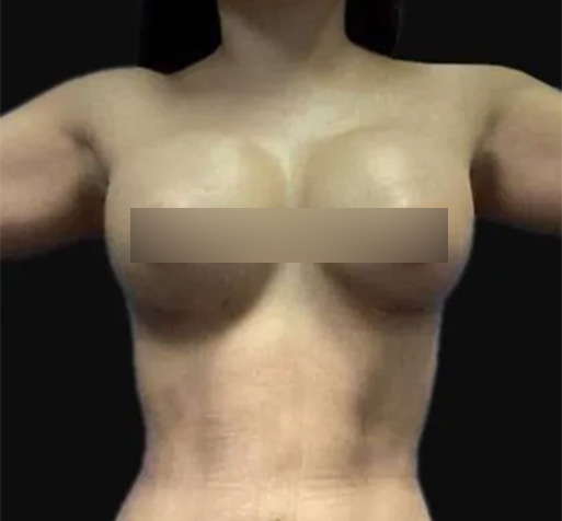 B&A