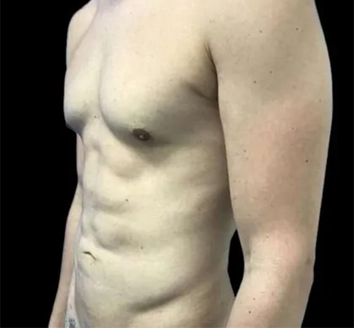 B&A